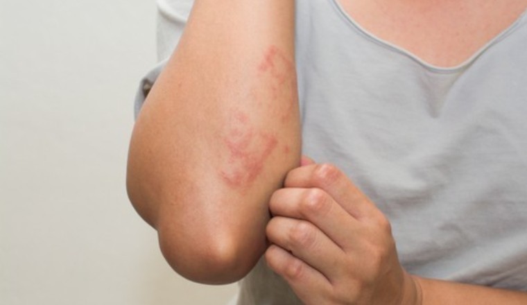 5 dấu hiệu của bệnh ung thư bạn cần biết