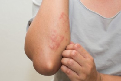 5 dấu hiệu của bệnh ung thư bạn cần biết