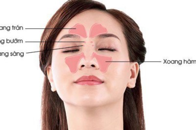 Các phương pháp và bài thuốc hay trị viêm xoang tại nhà