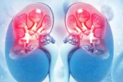Nhưng dấu hiệu nhận biết có thể bạn đã mắc bệnh Thận