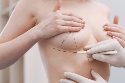 Túi độn ngực có thể gây ung thư