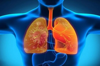 7 cây thuốc vị thuốc và món ăn hỗ trợ người bệnh phổi mạn tính lúc giao mùa