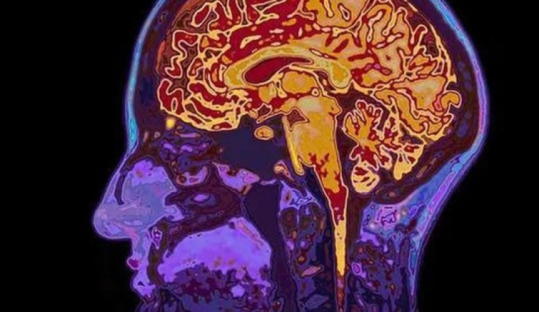 Giải mã suy nghĩ bằng kỹ thuật quét não (fMRI: Phương pháp 'đọc suy nghĩ' của bất kỳ ai mà chẳng cần chạm vào đầu)