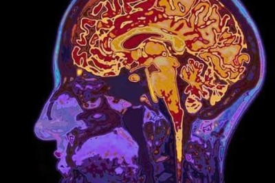 Giải mã suy nghĩ bằng kỹ thuật quét não (fMRI: Phương pháp 'đọc suy nghĩ' của bất kỳ ai mà chẳng cần chạm vào đầu)