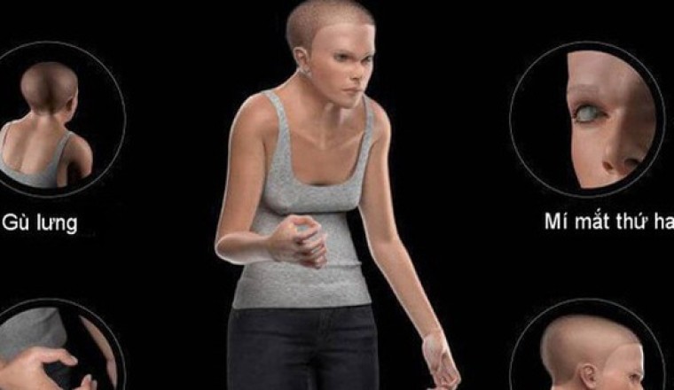 Nghiên cứu mới: Con người sẽ 'biến dạng' đáng sợ vì smartphone, laptop