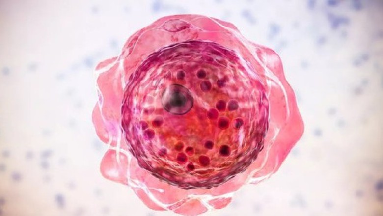 Đã tìm ra thuốc điều trị amip ăn não chết người