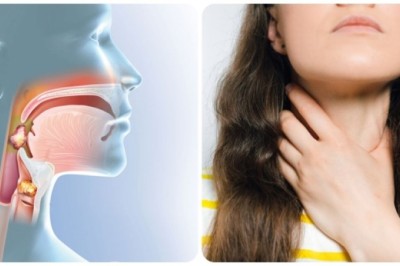 Đọc ngay để biết Dấu hiệu ung thư vòm họng giai đoạn đầu