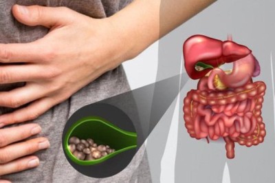 Bệnh polyp túi mật nguyên nhân và điều trị polyp túi mật