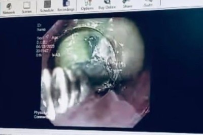 Nuốt mật lợn chữa đau bụng theo dân gian, người phụ nữ nguy kịch