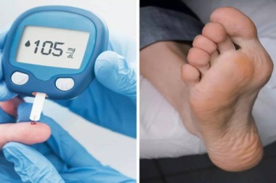 3 biểu hiện khác thường ở bàn chân là dấu hiệu của bệnh Tiểu Đường