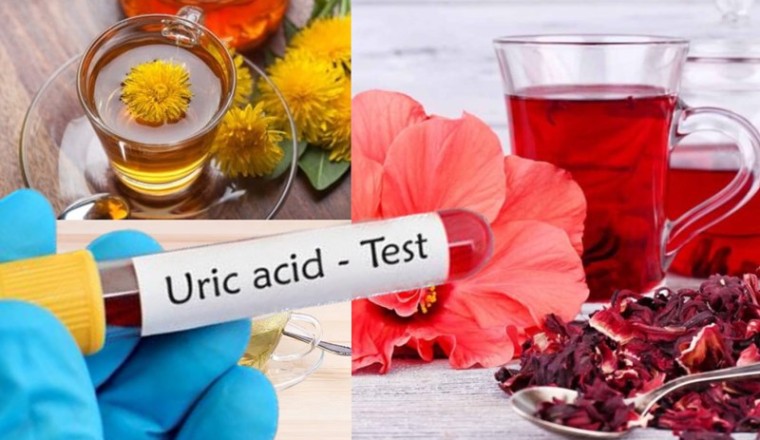 Người (Bệnh Gút) còn gọi nồng độ axit uric trong máu cao đây là 4 Loại Thảo Dược nên hàng hàng ngày