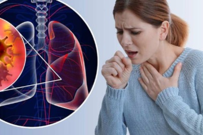 Bài thuốc tốt giúp hỗ trợ người bệnh ung thư phổi sau hóa trị và xạ trị