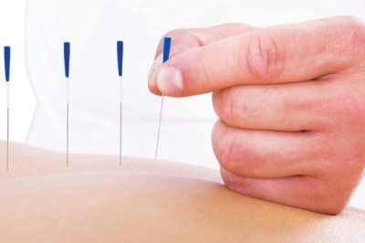 Châm cứu bấm huyệt thế mạnh của Y học Việt Nam