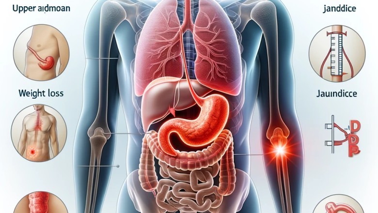 Phát Hiện Sớm Ung Thư Tuyến Tụy: 5 Dấu Hiệu Cảnh Báo Quan Trọng Bạn Không Thể Bỏ Qua