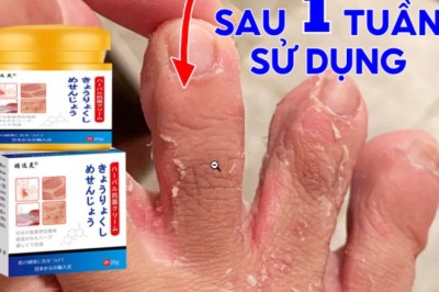 Giới Thiệu Sản Phẩm: Kem Bôi Viêm Da Cơ Địa NHẬT BẢN cần có trong Mùa mưa lũ