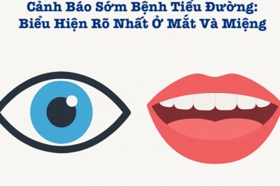Cảnh Báo Sớm Bệnh Tiểu Đường: Biểu Hiện Rõ Nhất Ở Mắt Và Miệng