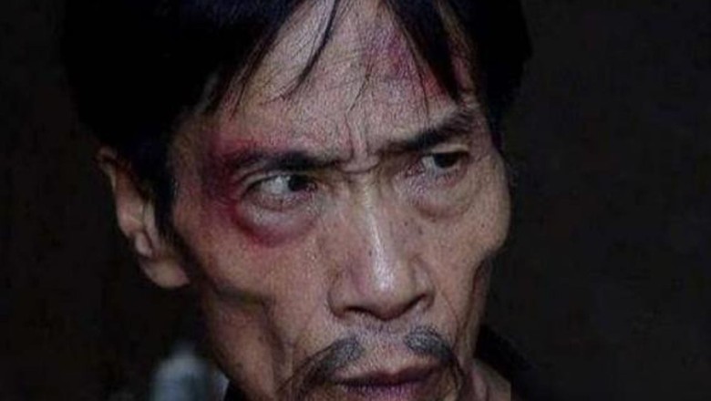 Tại sao người hai má không có thịt không nên kết giao?