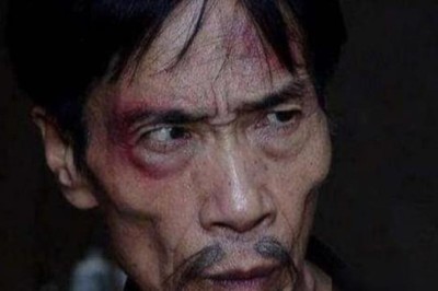 Tại sao người hai má không có thịt không nên kết giao?